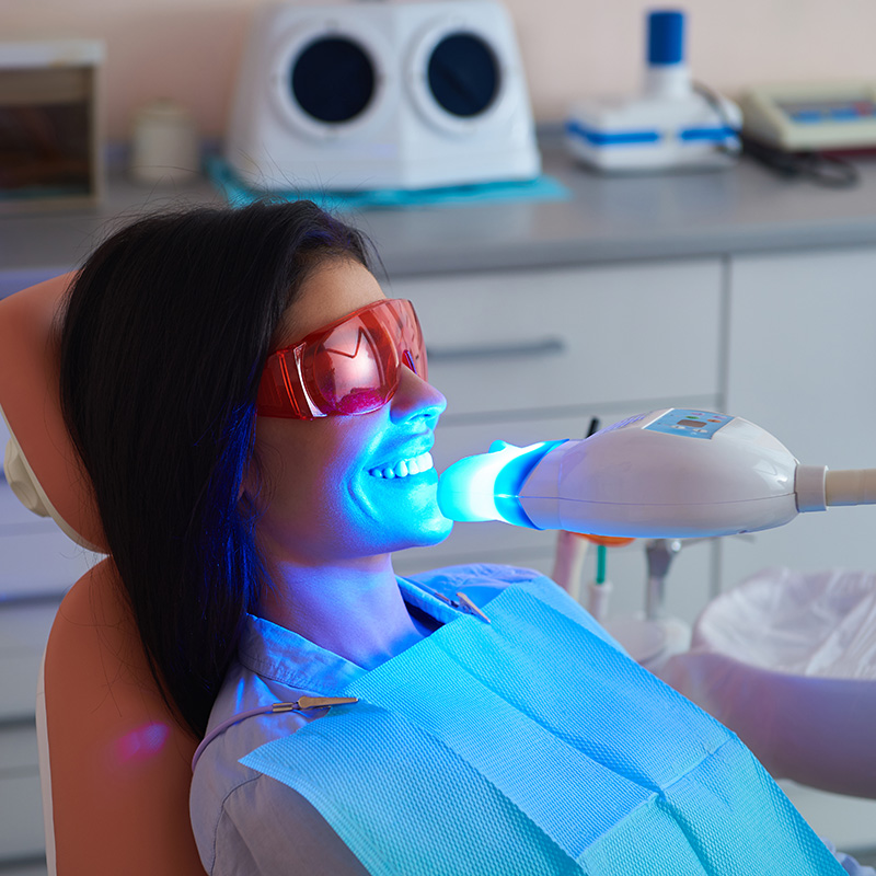 ホワイトニング（オフィス）